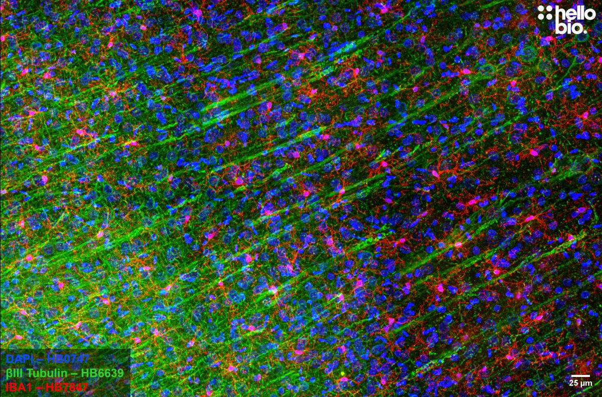 Figure 5. IBA1 expressing microglia in the cortex