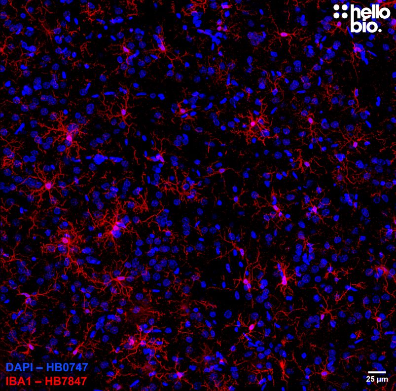 Figure 8. Microglia expressing IBA1 in rat brain