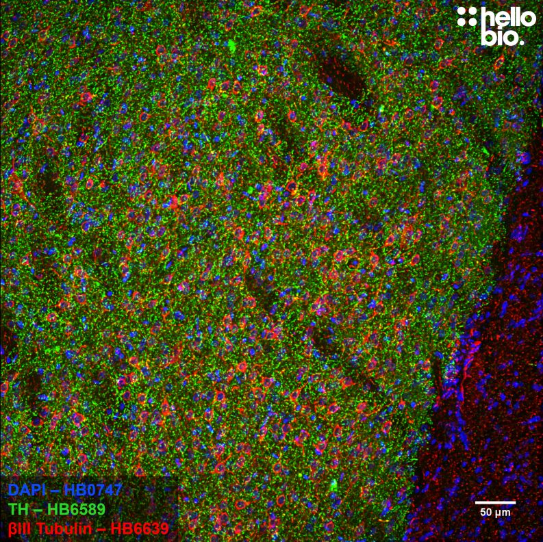 Figure 6. βIII tubulin and tyrosine hydroxylase staining in rat caudate putamen.