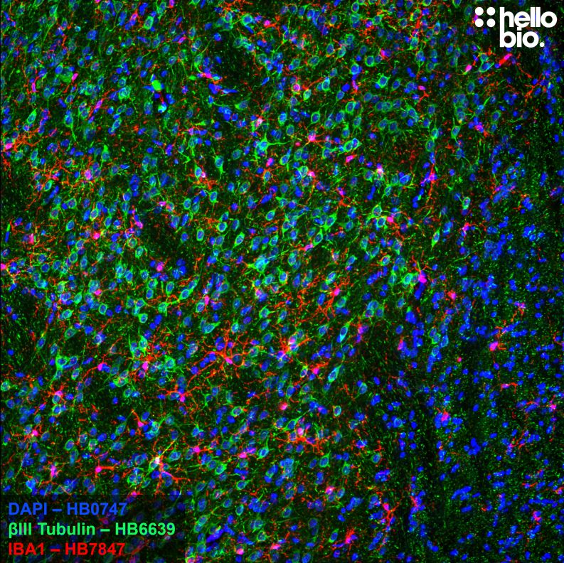 Figure 3. Microglia and neurons stained in the caudate putamen