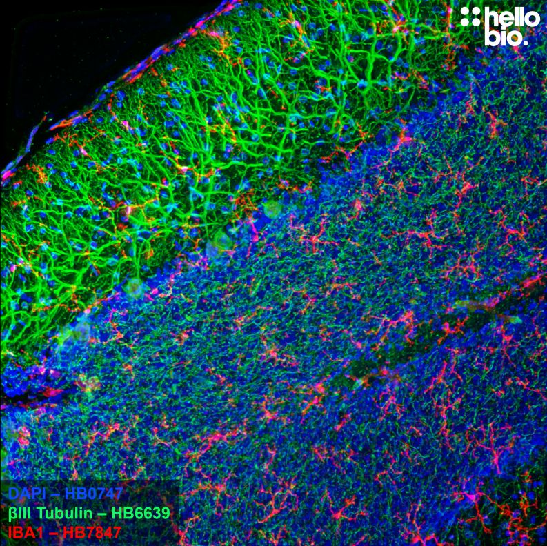 Figure 9. Microglia and Purkinje cells in the cerebellum