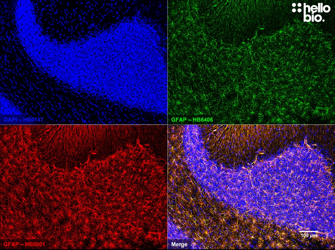 Figure 7. Independent antibody validation of HB8001 and HB6406 in rat cerebellum.