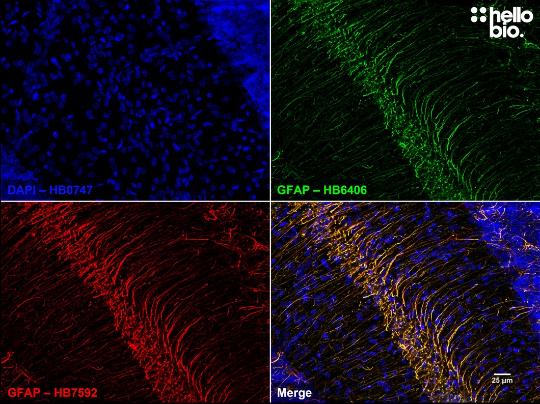 Figure 4. Independent antibody validation of HB7592 and HB6406.