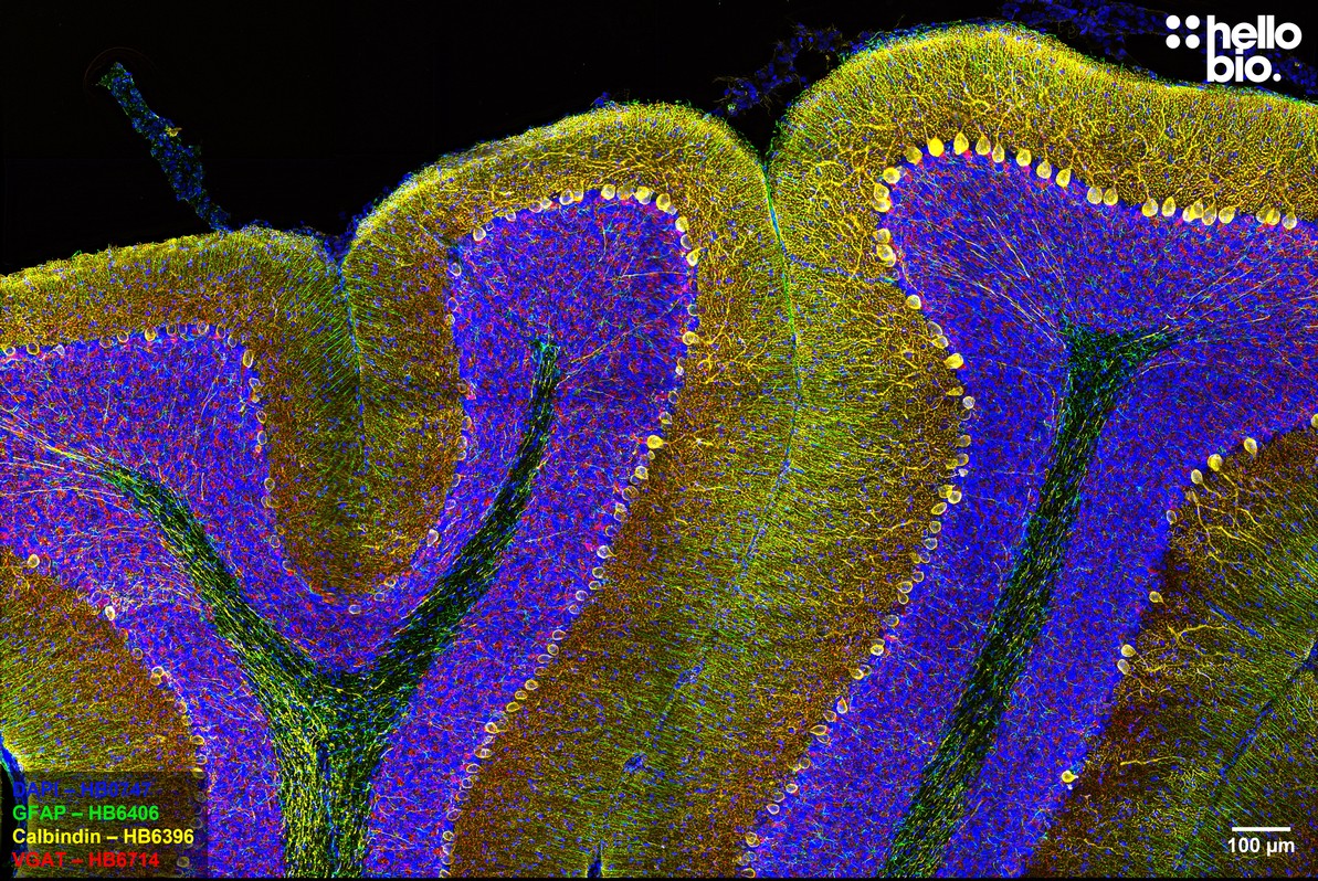 Figure 4. VGAT, Calbindin and GFAP expression in rat cerebellum.