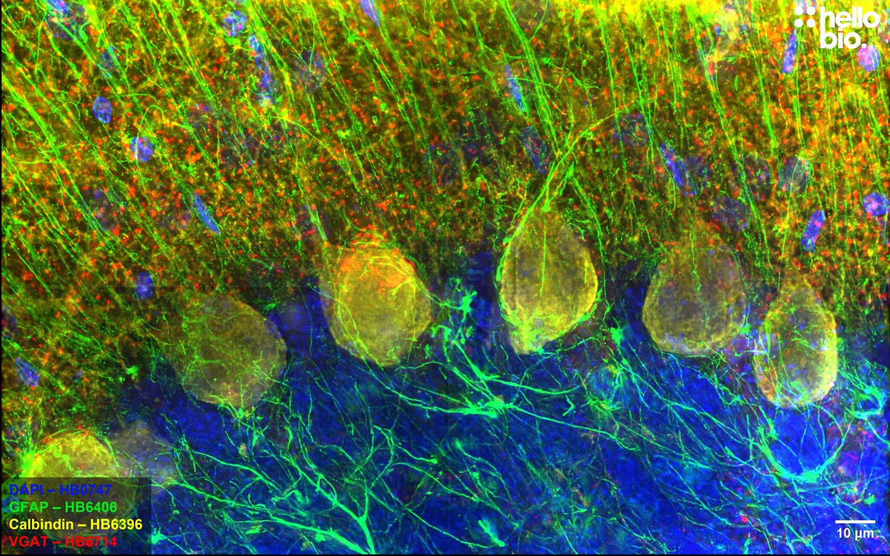 Figure 5. VGAT, Calbindin and GFAP expression in rat cerebellum.