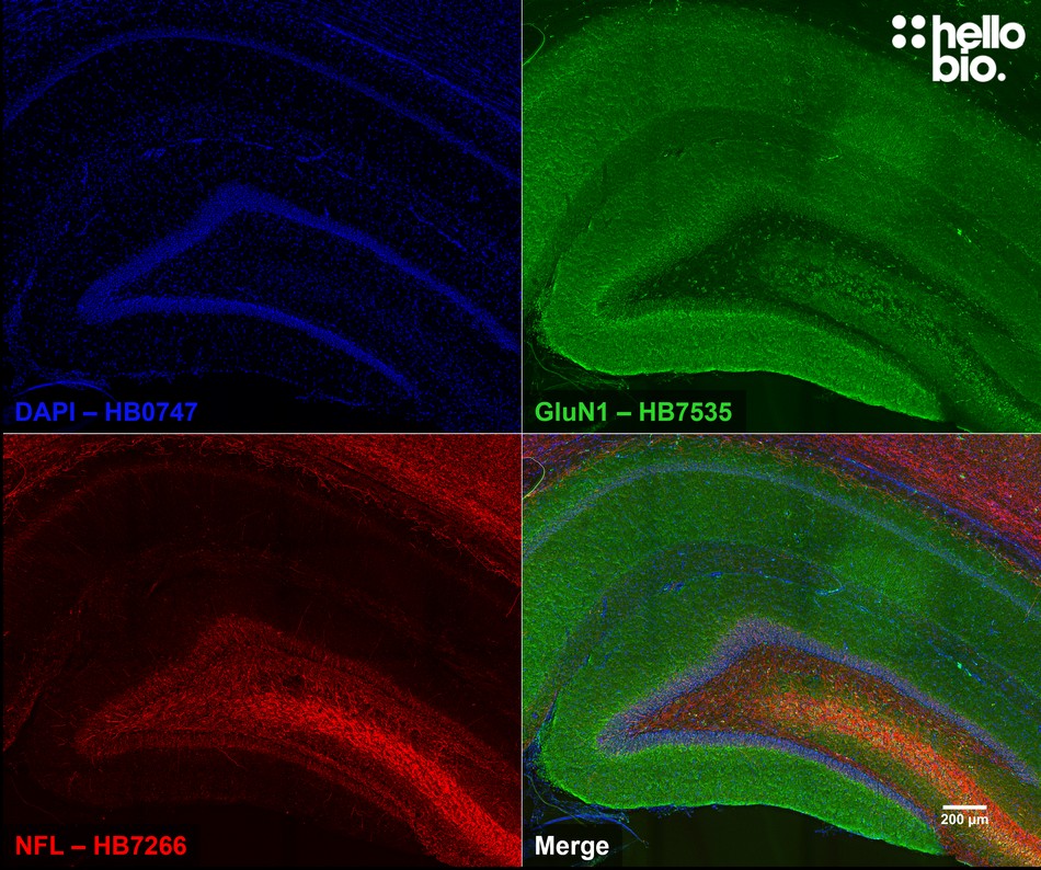 Figure 5. GluN1 expression in rat dentate gyrus mapped using HB7535.