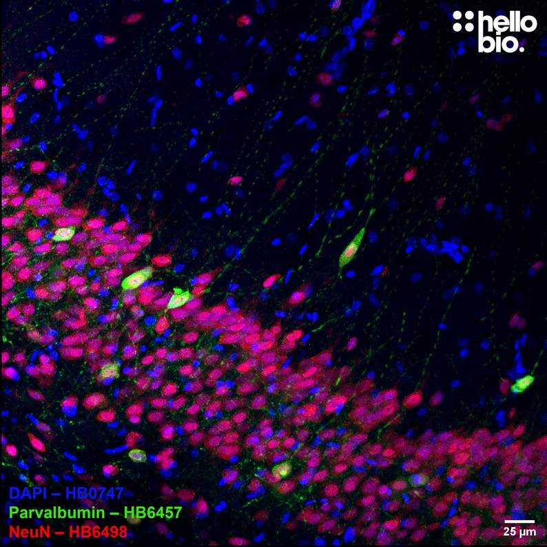 Figure 3. Parvalbumin expressing interneurons in hippocampal CA1.