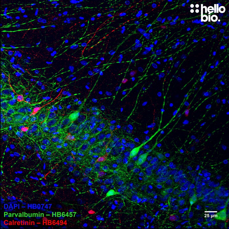 Figure 7. Parvalbumin and Calretinin expressing interneurons in hippocampal CA1.