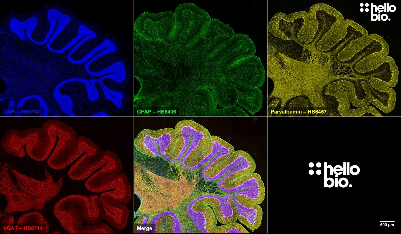 Figure 5. Whole cerebellum section stained for VGAT, Parvalbumin and GFAP.