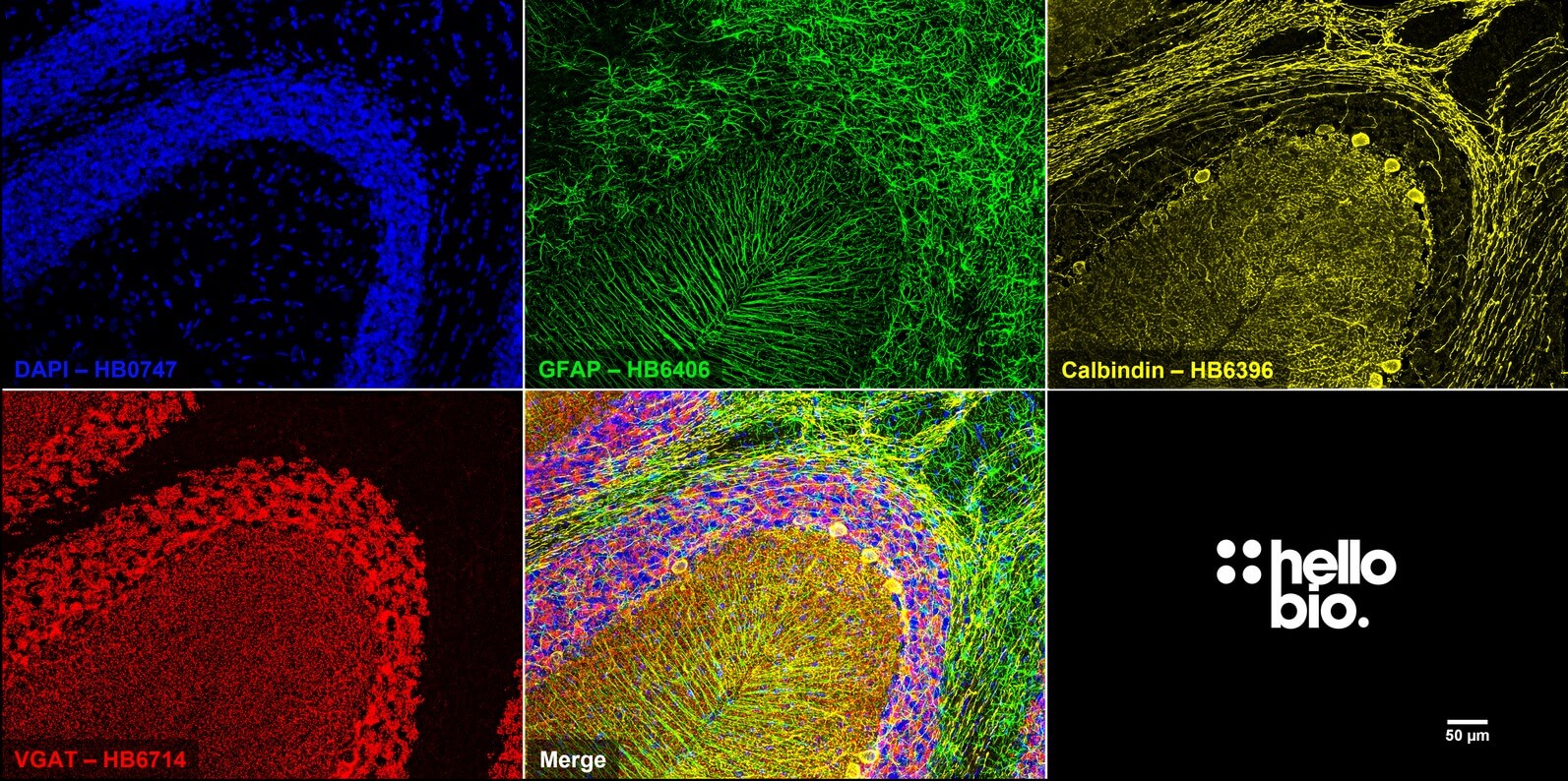 Figure 10. VGAT, Calbindin and GFAP expression in rat cerebellum.