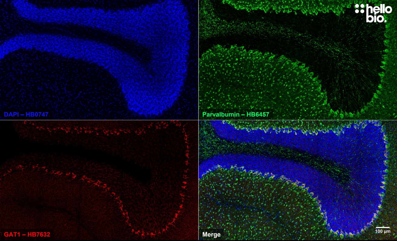 Figure 9. Parvalbumin and GAT1 expressing neurons in rat cerebellum.