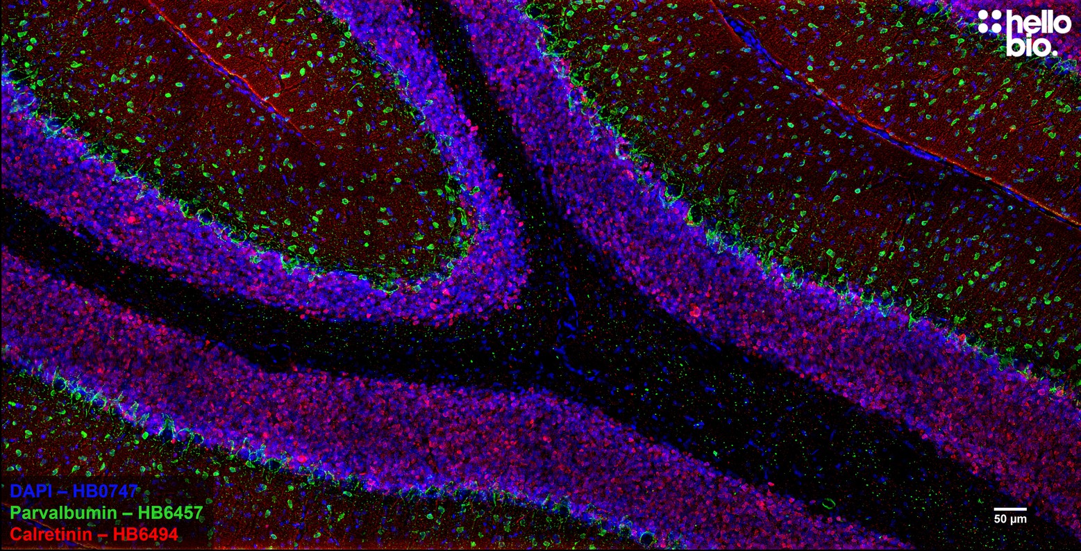 Figure 8. Parvalbumin and Calretinin expressing neurons in rat cerebellum.