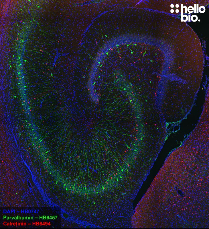 Figure 10. Parvalbumin and Calretinin expressing interneurons in the rat hippocampus