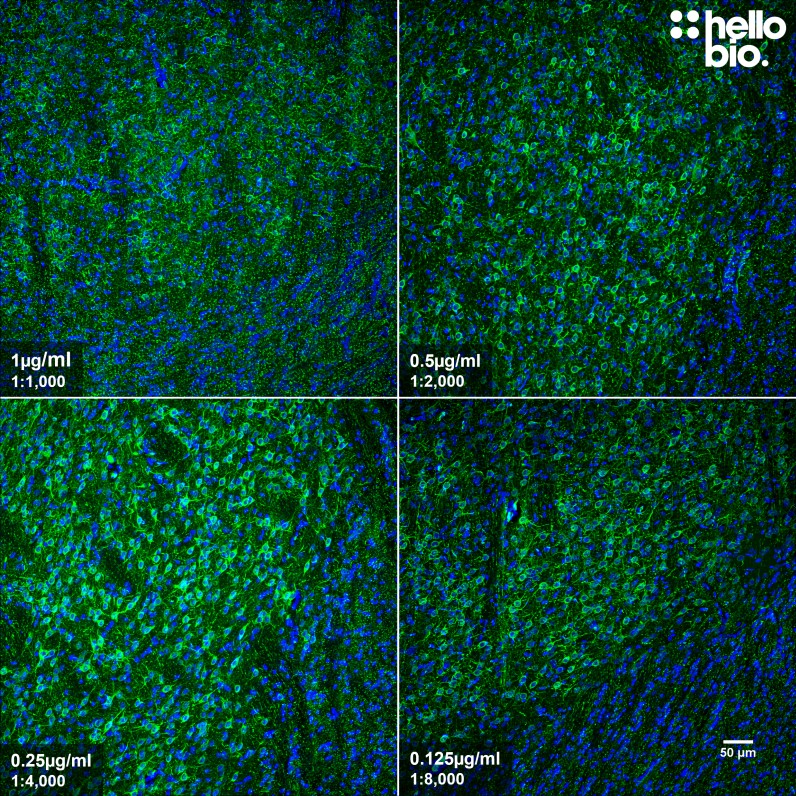 Figure 5. Concentration response of HB6639 in rat caudate putamen