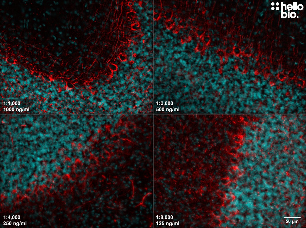 Figure 7. The effect of varying HB7266 concentration upon staining in rat cerebellum. 