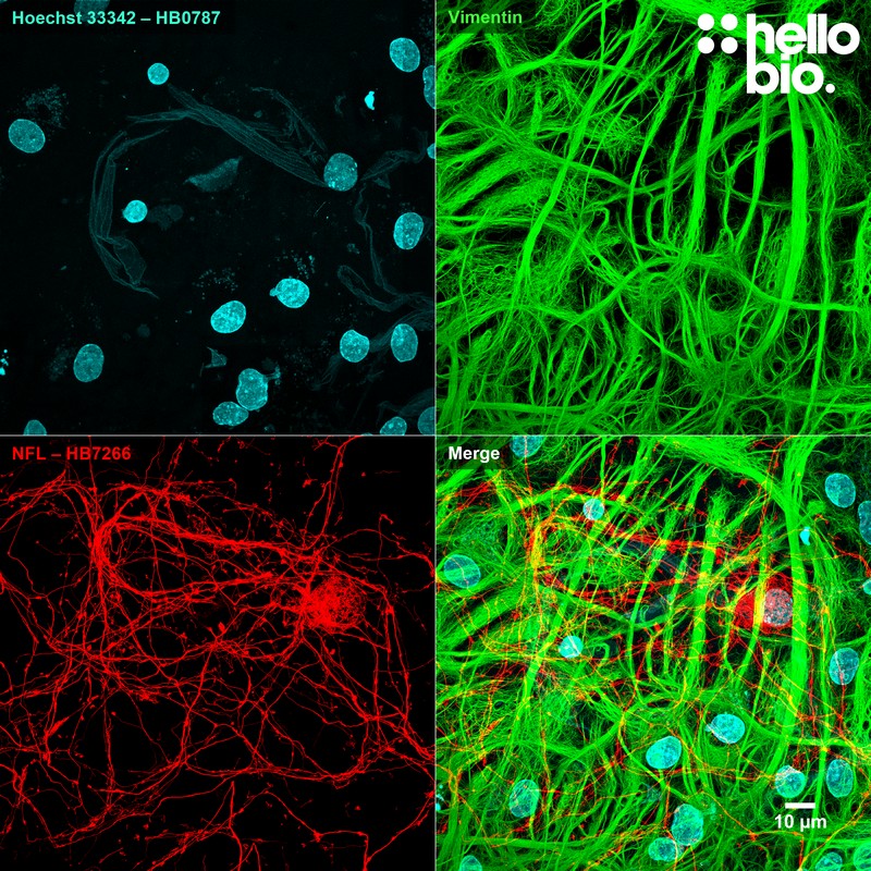 Figure 10. Neurofilament L (HB7266) and Vimentin staining in cultured rat neurones. 