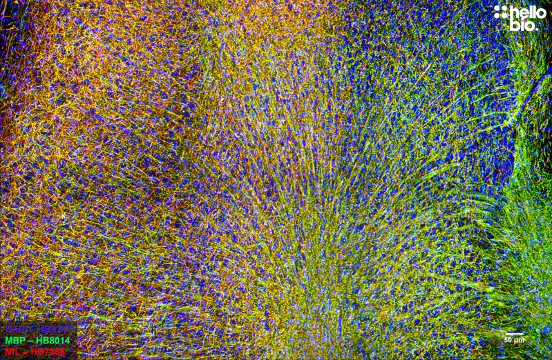 Figure 12. MBP and Neurofilament L staining in rat subiculum. Mounted using MightyMount<sup>TM</sup> Antifade Fluorescence Mounting Medium (aqueous).