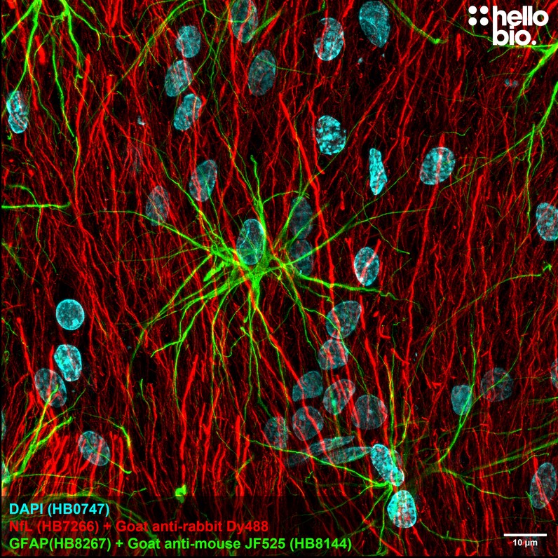 Figure 1. GFAP staining using HB8144 Goat Anti-Mouse IgG H&L (Janelia Fluor® 525) preadsorbed secondary antibody.