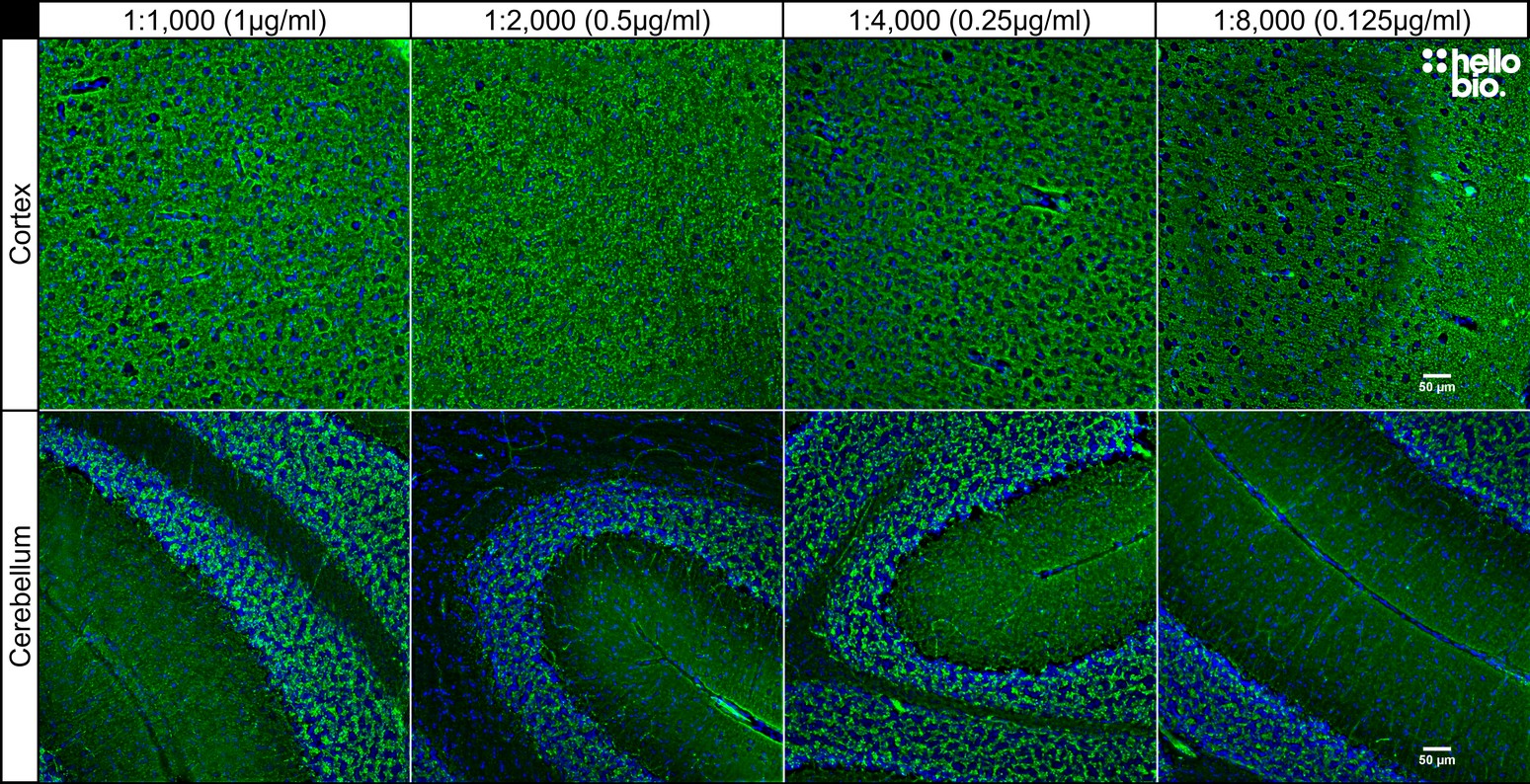 Figure 10. Concentration response of HB6378 staining in rat cortex and cerebellum.