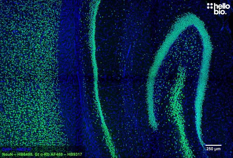 Figure 2. Neurons stained for NeuN in the rat hippocampus using HB6498 and HB9317 Goat Anti-Rabbit H&L (AF488).