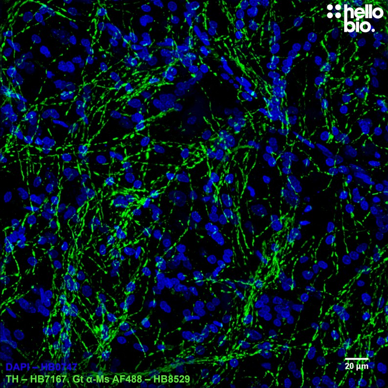 Figure 7. Tyrosine hydroxlase staining in rat midbrain using HB8529 Goat Anti-Mouse H&L (AF488) secondary antibody