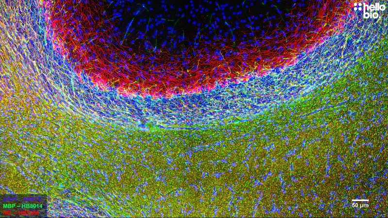 Figure 11. MBP and Neurofilament L staining in rat cerebellum. Mounted using MightyMount<sup>TM</sup> Antifade Fluorescence Mounting Medium (aqueous).