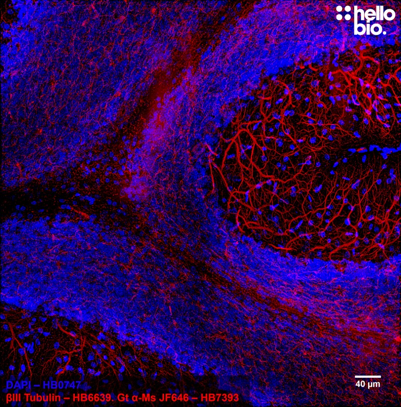 Figure 6. Purkinje neurons stained for βIII tubulin in rat cerebellum using HB6639 and HB7393 Goat Anti-Mouse H&L (Janelia Fluor® 646).