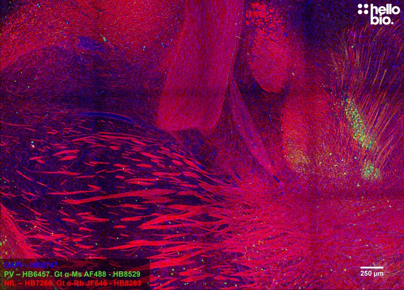 Figure 1. Neurofilament L and Parvalbumin staining in rat midbrain using HB8283 Goat Anti-Rabbit H&L (Janelia Fluor® 646) and HB8529 Goat Anti-Mouse H&L (AF488)