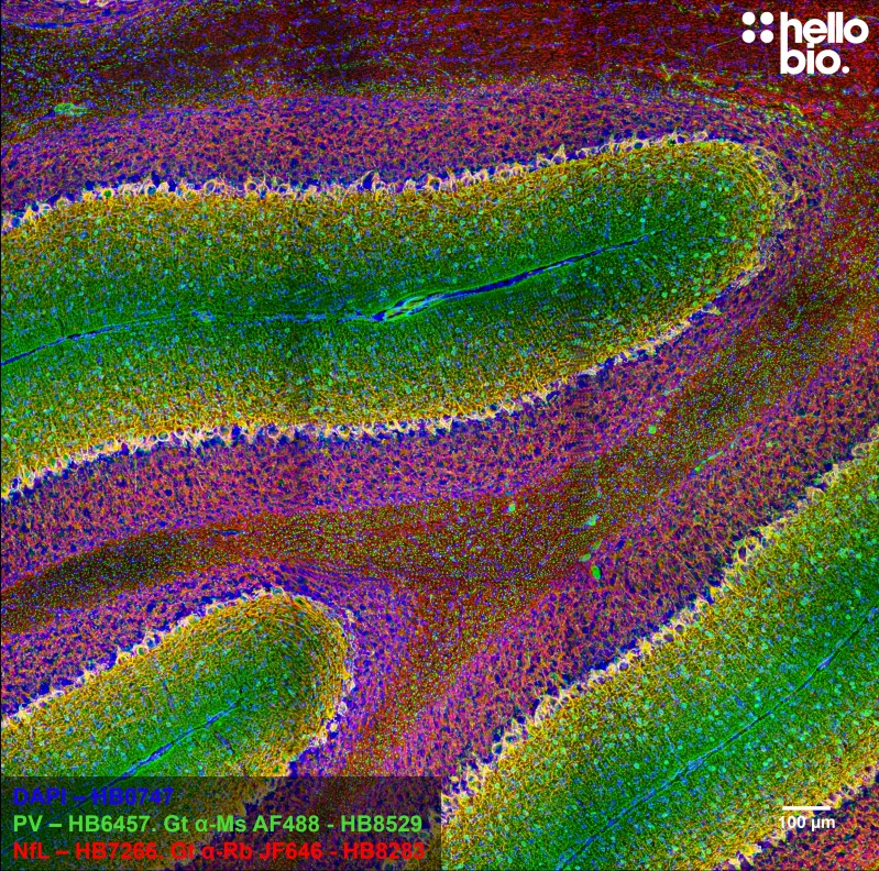 Figure 3. Parvalbumin and Neurofilament L and staining in rat cerebellum using HB8529 Goat Anti-Mouse H&L (AF488) and HB8283 Goat Anti-Rabbit H&L (Janelia Fluor® 646)