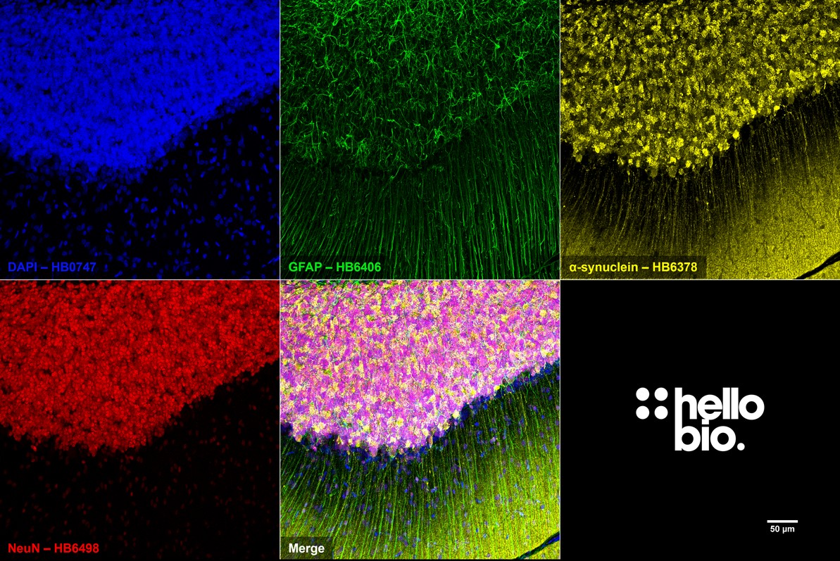 Figure 5. α-Synuclein, NeuN and GFAP staining in rat cerebellum