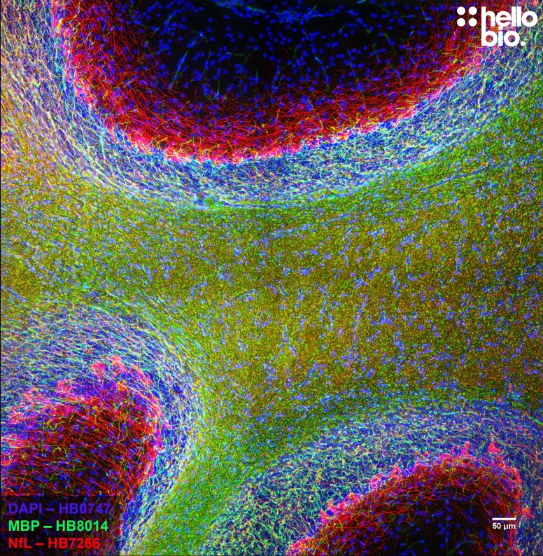 Figure 3. MBP and Neurofilament L staining in rat cerebellum. Mounted using MightyMount<sup>TM</sup> Antifade Fluorescence Mounting Medium (aqueous).