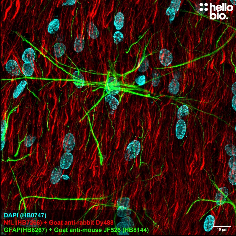 Figure 2. GFAP staining using HB8144 Goat Anti-Mouse IgG H&L (Janelia Fluor® 525) preadsorbed secondary antibody.