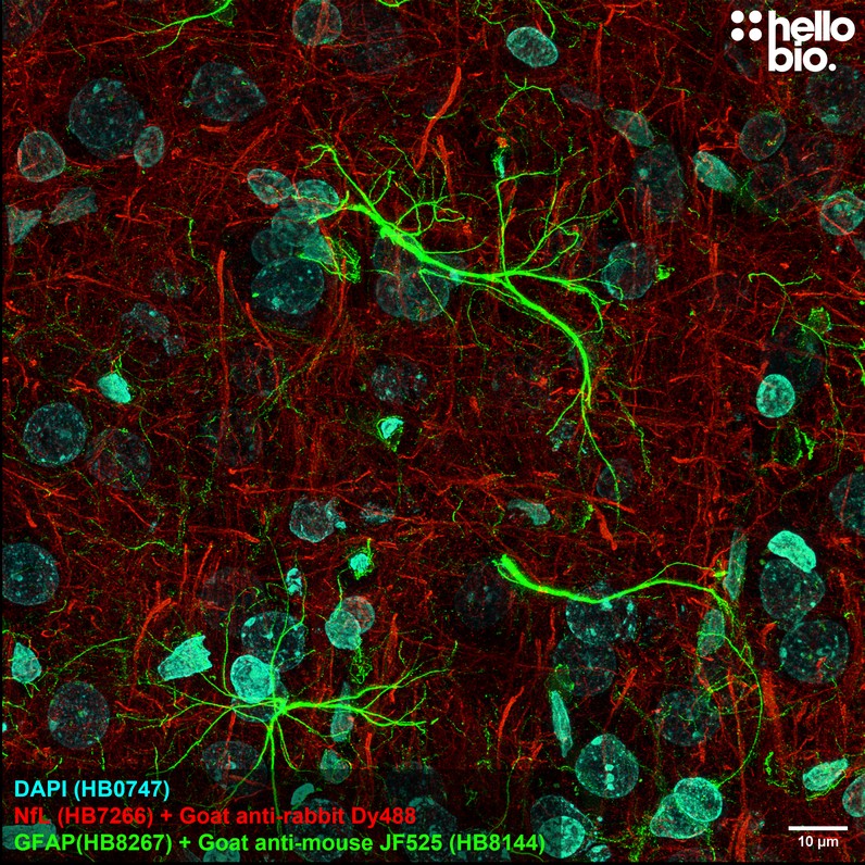 Figure 3. GFAP staining using HB8144 Goat Anti-Mouse IgG H&L (Janelia Fluor® 525) preadsorbed secondary antibody.