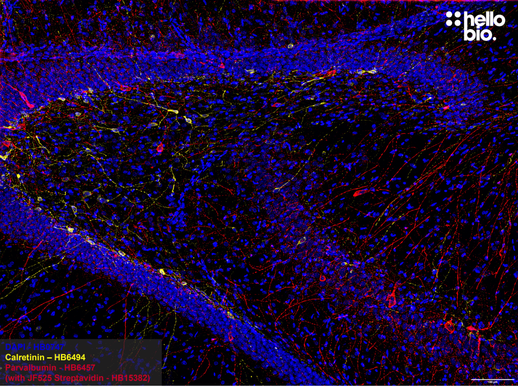 Figure 1. Parvalbumin and Calretinin expressing interneurons in the rat hippocampus.