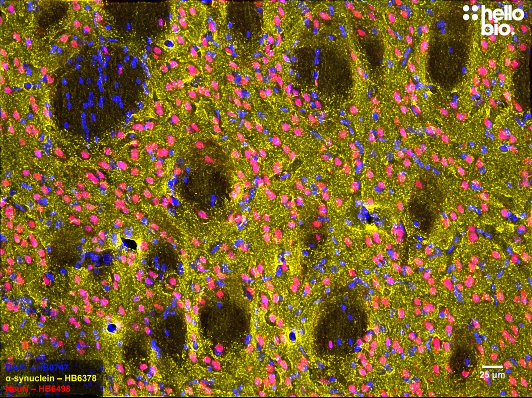 Figure 12. α-Synuclein staining in rat caudate putamen