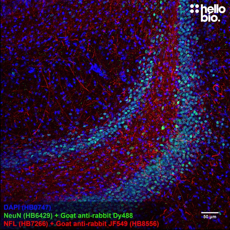 Figure 2. Neurofilament L staining in rat hippocampus using HB8556 Goat Anti-Rabbit IgG H&L (Janelia Fluor® 549) preadsorbed secondary antibody.