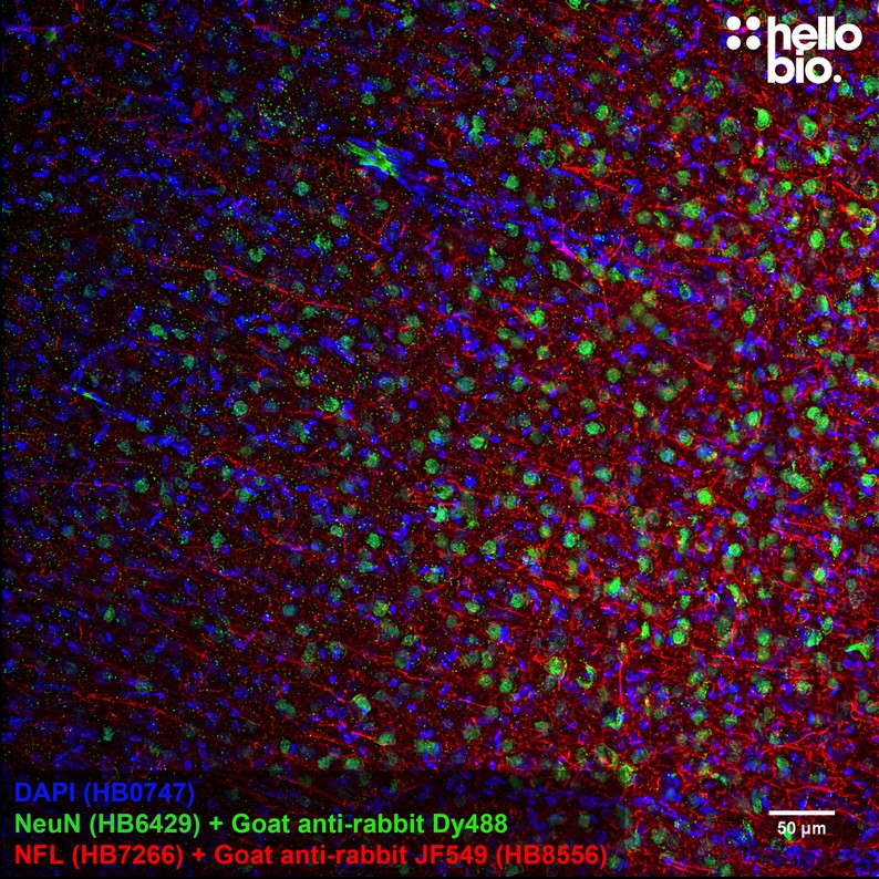 Figure 5. Neurofilament L staining in rat cortex using HB8556 Goat Anti-Rabbit IgG H&L (Janelia Fluor® 549) preadsorbed secondary antibody.