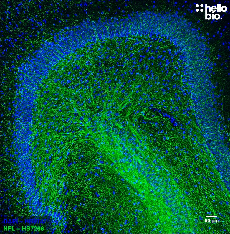 Figure 7. Neurofilament L staining in rat dentate gyrus. Mounted using MightyMount<sup>TM</sup> Antifade Fluorescence Mounting Medium with DAPI (aqueous).