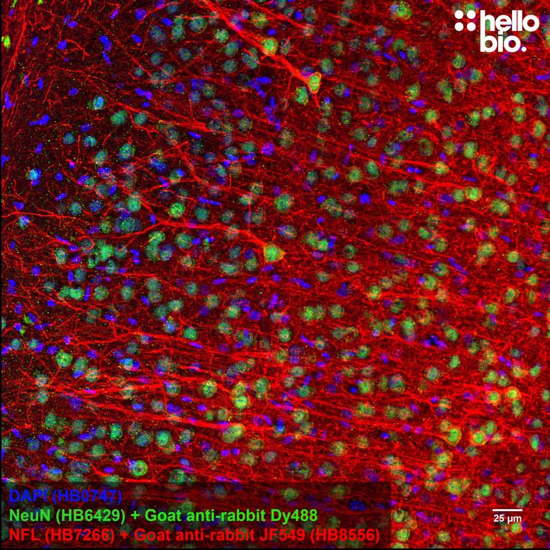 Figure 3. Neurofilament L staining in rat cortex using HB8556 Goat Anti-Rabbit IgG H&L (Janelia Fluor® 549) preadsorbed secondary antibody.