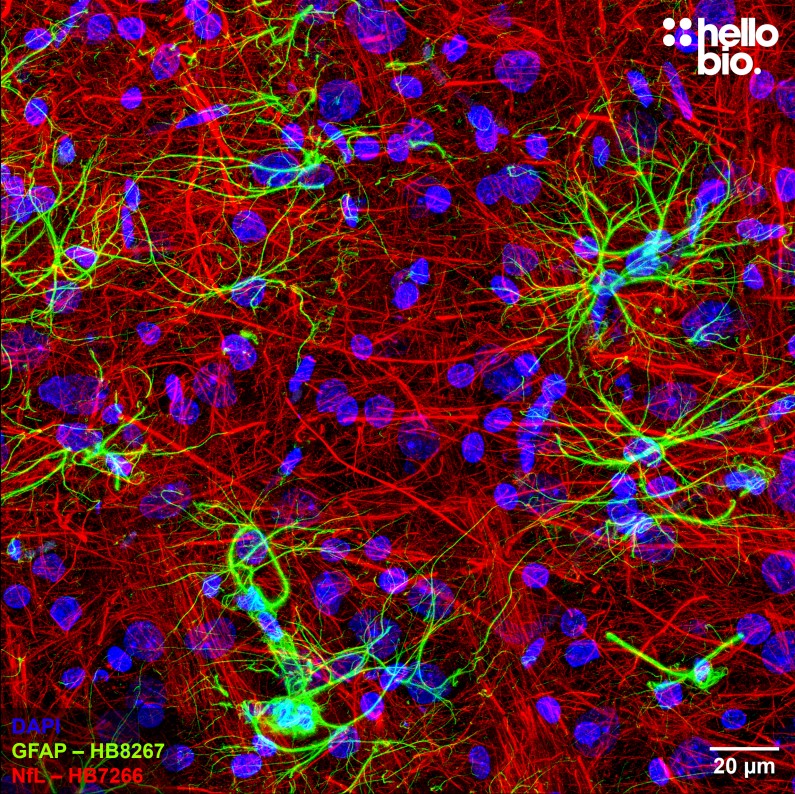 Figure 2. GFAP and Neurofilament L staining in rat cortex. Mounted using MightyMount<sup>TM</sup> Antifade Fluorescence Mounting Medium with DAPI (aqueous).