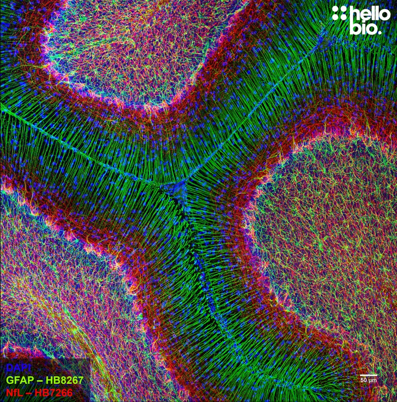 Figure 1. GFAP and Neurofilament L staining in rat cerebellum. Mounted using MightyMount<sup>TM</sup> Antifade Fluorescence Mounting Medium with DAPI (aqueous).