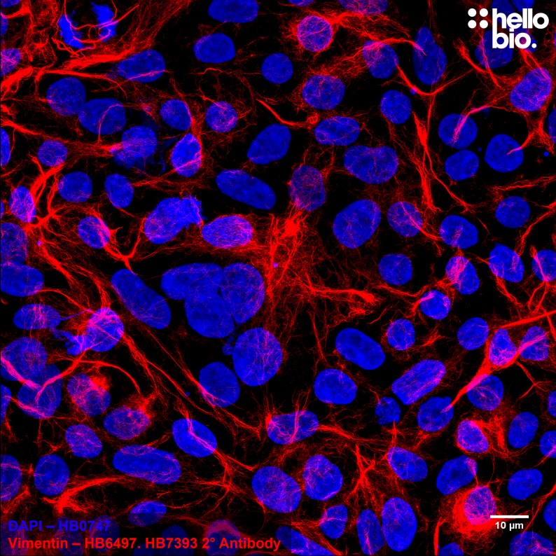 Figure 1. Vimentin expression in HEK293T cells visualised using HB6497 and HB7393 Goat Anti-Mouse H&L (Janelia Fluor® 646).