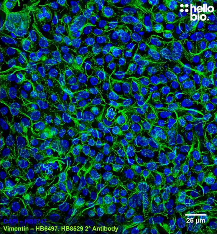 Figure 4. Vimentin staining in HEK293T cells using HB8529 Goat Anti-Mouse H&L (AF488).