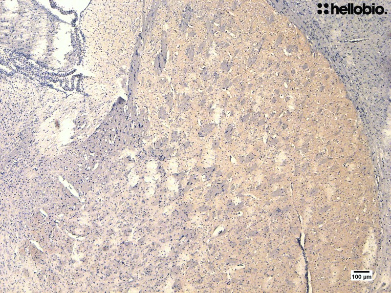 Figure 4. Tyrosine hydroxylase visualized in mouse striatum using DAB staining