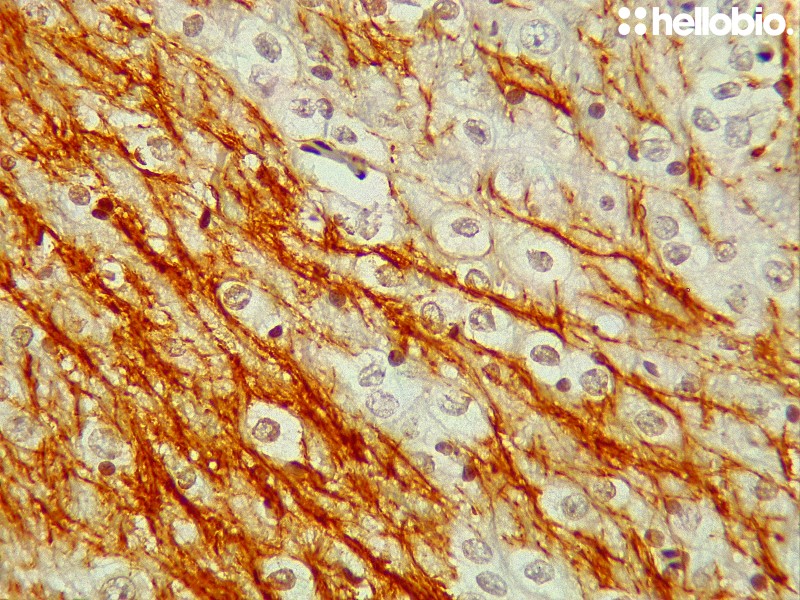 Figure 8. Tyrosine hydroxylase staining of midbrain dopaminergic fibres visualized using biotin-streptavidin detection.