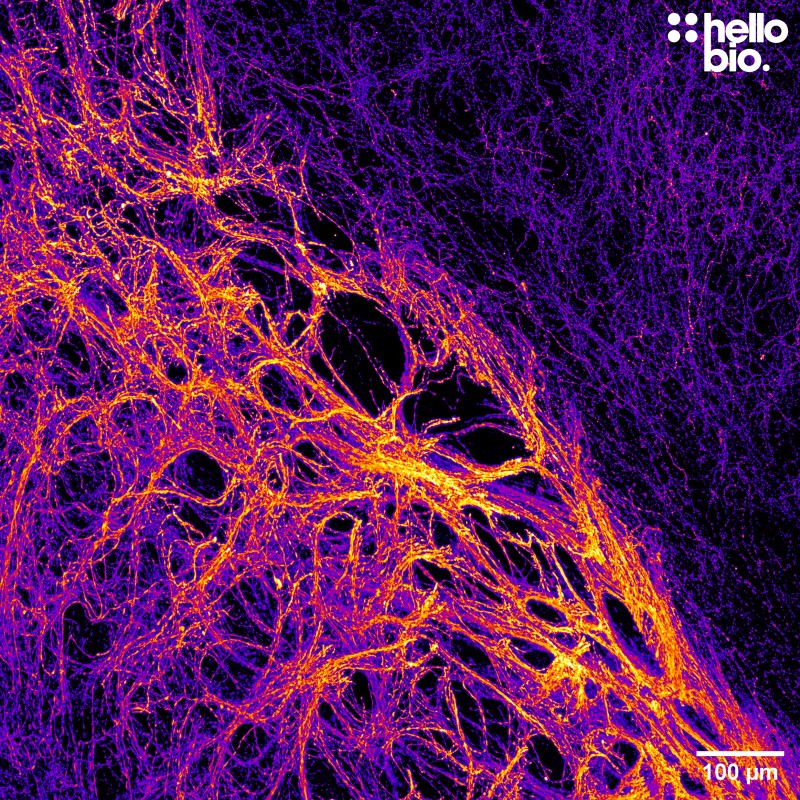 Figure 2. Cleared mouse brain segment stained for tyrosine hydroxylase showing dopaminergic projections towards the striatum