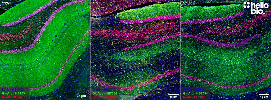 Figure 5. Concentration response of HB7534 staining in rat hippocampus.