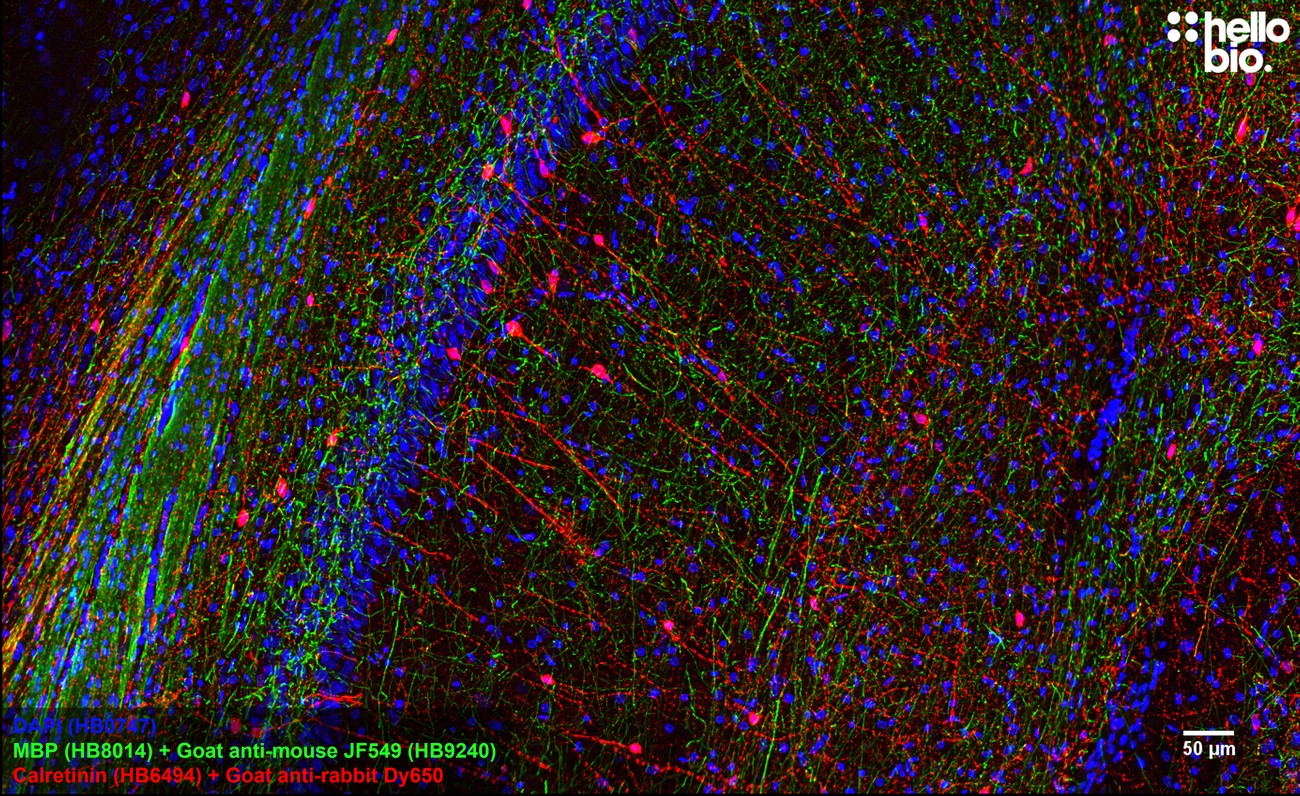 Figure 3. MBP staining using HB9240 Goat Anti-Mouse IgG H&L (Janelia Fluor® 549) preadsorbed secondary antibody.