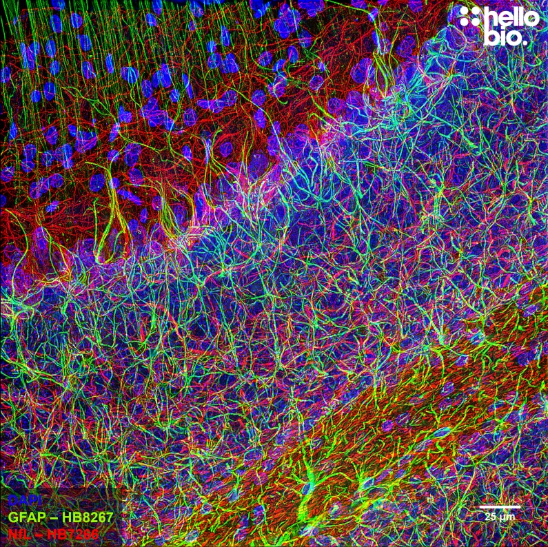 Figure 5. GFAP and Neurofilament L staining in rat hippocampus. Mounted using MightyMount<sup>TM</sup> Antifade Fluorescence Mounting Medium with DAPI (aqueous).