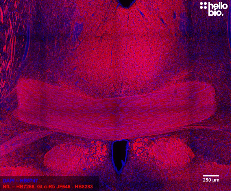 Figure 8. Neurofilament L in rat corpus callosum using HB8283 Goat Anti-Rabbit H&L (Janelia Fluor® 646)